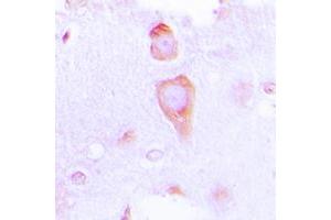 Immunohistochemical analysis of GUCY1B3 staining in human brain formalin fixed paraffin embedded tissue section.