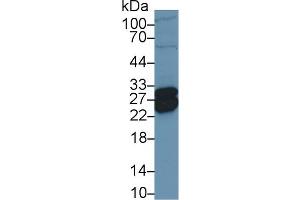 Detection of TNNI1 in Porcine Heart lysate using Polyclonal Antibody to Troponin I Type 1, Slow Skeletal (TNNI1) (TNNI1 抗体  (AA 1-187))