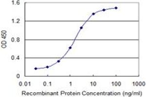 Detection limit for recombinant GST tagged DYRK1B is 0. (DYRK1B 抗体  (AA 479-569))