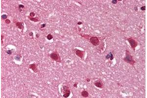 Human Brain, Cortex (formalin-fixed, paraffin-embedded) stained with DNM1 antibody ABIN291352 at 10 ug/ml followed by biotinylated goat anti-rabbit IgG secondary antibody ABIN481713, alkaline phosphatase-streptavidin and chromogen. (Dynamin 1 抗体  (C-Term))