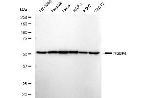 Western blotting analysis using RBBP4 antibody (ABIN7800185). (Recombinant Retinoblastoma Binding Protein 4 抗体)