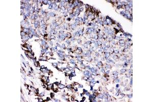 IHC analysis of AEBP2 using anti-AEBP2 antibody (ABIN4886435). (AEBP2 抗体  (AA 424-517))