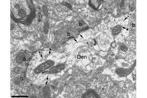 Electron micrograph shows K75/41 immunolabelling in the hippocampus using a pre-embedding immunogold method.
