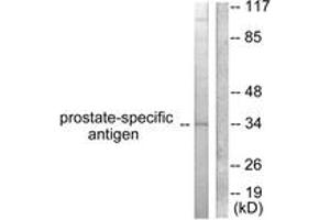 Western blot analysis of extracts from mouse heart cells, using Prostate-specific Antigen Antibody. (Prostate Specific Antigen 抗体  (AA 81-130))