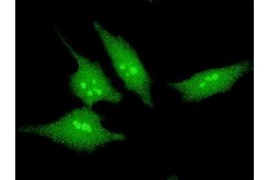 Immunofluorescence of monoclonal antibody to SCAND2 on HeLa cell. (SCAND2 抗体  (AA 1-62))