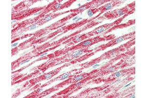 Human, Heart: Formalin-Fixed Paraffin-Embedded (FFPE). (HADH 抗体  (C-Term))