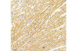 Immunohistochemistry of paraffin embedded rat heart using Sarcomeric α Actinin (ABIN7075510) at dilution of 1: 1000 (200x lens) (Sarcomeric alpha Actinin 抗体)