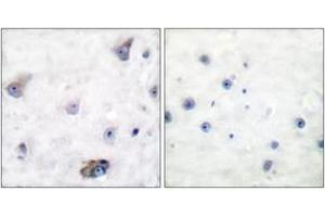 Immunohistochemistry analysis of paraffin-embedded human brain, using GABA-RB (Phospho-Ser434) Antibody. (GABA-RB (AA 401-450), (pSer434) 抗体)