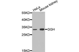 Western blot analysis of extracts of various cell lines, using GGH antibody (ABIN5973177) at 1/1000 dilution. (GGH 抗体)