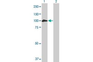 Western Blot analysis of CTNNA2 expression in transfected 293T cell line by CTNNA2 MaxPab polyclonal antibody. (CTNNA2 抗体  (AA 1-905))