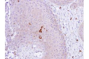 Immunohistochemistry (IHC) image for anti-Peptidyl Arginine Deiminase, Type IV (PADI4) (Center) antibody (ABIN2856939)