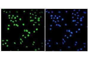IF analysis of SMARCA2/BRM using anti-SMARCA2/BRM antibody (ABIN7600365).