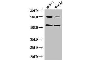 Western Blot Positive WB detected in: MCF-7 whole cell lysate, HepG2 whole cell lysate All lanes: FOXC1 antibody at 3 μg/mL Secondary Goat polyclonal to rabbit IgG at 1/50000 dilution Predicted band size: 57 kDa Observed band size: 57 kDa (FOXC1 抗体  (AA 1-79))