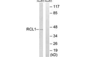 Western blot analysis of extracts from HuvEc cells, using RCL1 Antibody.