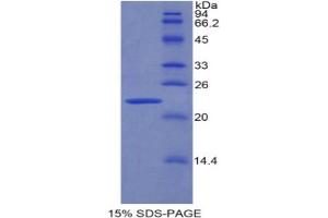 SDS-PAGE analysis of Rat PPARG Protein. (PPARG 蛋白)