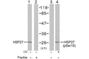 Image no. 2 for anti-Heat Shock 27kDa Protein 1 (HSPB1) (Ser15) antibody (ABIN197344) (HSP27 抗体  (Ser15))