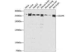 Western blot analysis of extracts of various cell lines using CKAP5 Polyclonal Antibody at dilution of 1:1000. (CKAP5 抗体)