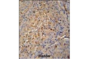 Immunohistochemistry (Paraffin-embedded Sections) (IHC (p)) image for anti-Microtubule-Associated Protein, RP/EB Family, Member 1 (MAPRE1) (AA 44-71), (N-Term) antibody (ABIN652240)