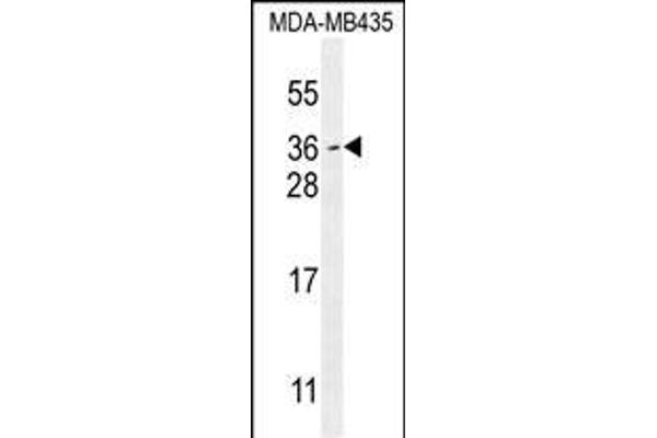 Myc Target 1 抗体  (C-Term)