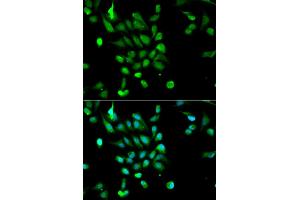 Immunofluorescence analysis of MCF-7 cells using PSMC5 antibody. (PSMC5 抗体)