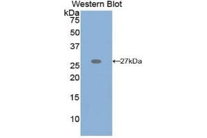 Western blot analysis of the recombinant protein. (GRIP1 抗体  (AA 874-1073))