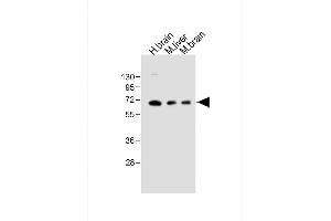 All lanes : Anti-GLS2 Antibody (C-term ) at 1:1000 dilution Lane 1: Human brain lysate Lane 2: Mouse liver lysate Lane 3: Mouse brain lysate Lysates/proteins at 20 μg per lane. (GLS2 抗体  (AA 498-524))