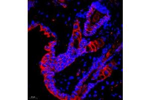 Immunofluorescence of paraffin embedded mouse skin using GDPD2 (ABIN7074098) at dilution of 1:650 (400x lens) (GDPD2 抗体)