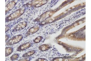 Immunoperoxidase of monoclonal antibody to TOMM22 on formalin-fixed paraffin-embedded human small Intestine.
