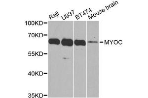Western blot analysis of extracts of various cell lines, using MYOC antibody (ABIN5970768) at 1/1000 dilution. (MYOC 抗体)