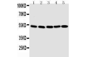Anti-Smad1 antibody, Western blotting Lane 1: SMMC Cell Lysate Lane 2: K562 Cell Lysate Lane 3:  Cell Lysate Lane 4: HELA Cell Lysate Lane 5: JURKAT Cell Lysate