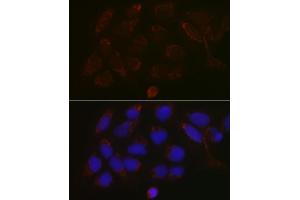 Immunofluorescence analysis of U-2 OS cells using G Rabbit pAb (ABIN6131444, ABIN6140942, ABIN6140944 and ABIN6218180) at dilution of 1:100 (40x lens). (GALNT3 抗体  (AA 1-140))