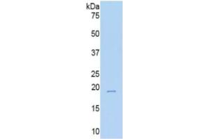 WB of Protein Standard: different control antibodies  against Highly purified E. (TNC ELISA 试剂盒)