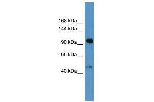 WB Suggested Anti-LPA Antibody Titration: 0. (LPA 抗体  (N-Term))