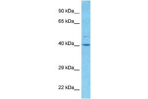 Host:  Rabbit  Target Name:  ALDOA  Sample Type:  RPMI-8226 Whole Cell lysates  Antibody Dilution:  1. (ALDOA 抗体  (C-Term))