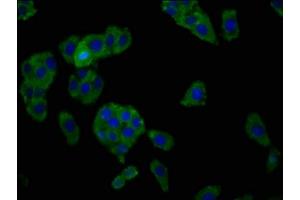 Immunofluorescence staining of HepG2 cells with ABIN7155172 at 1:166, counter-stained with DAPI. (SLC7A1 抗体  (AA 430-492))