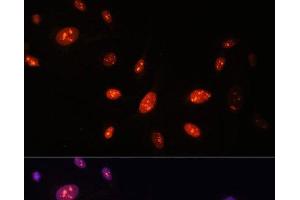 Immunofluorescence analysis of U-2 OS cells using ZNF177 Polyclonal Antibody at dilution of 1:100. (ZNF177 抗体)