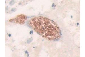 Immunohistochemistry (IHC) image for anti-Solute Carrier Family 4, Anion Exchanger, Member 1 (erythrocyte Membrane Protein Band 3, Diego Blood Group) (SLC4A1) (AA 35-290) antibody (ABIN7441895)