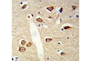 IHC analysis of FFPE mouse brain tissue stained with TLR3 antibody (TLR3 抗体)