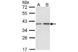 WB Image Sample (30 ug of whole cell lysate) A: A431 , B: H1299 12% SDS PAGE antibody diluted at 1:1000 (NAT2 抗体)