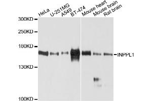 Western blot analysis of extracts of various cell lines, using INPPL1 antibody (ABIN4904065) at 1:1000 dilution. (INPPL1 抗体)