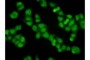 Immunofluorescence staining of Hela cells with ABIN7157277 at 1:100, counter-stained with DAPI. (KLHL2 抗体  (AA 1-200))