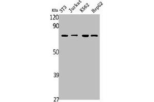 Western Blot analysis of NIH-3T3 Jurkat K562 HepG2 RAT-KIDNEY cells using SDHA Polyclonal Antibody (SDHA 抗体  (C-Term))