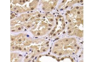 Immunohistochemistry of paraffin-embedded Human kidney using CSRP2BP Polyclonal Antibody at dilution of 1:100 (40x lens). (CSRP2BP 抗体)