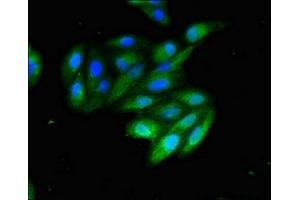 Immunofluorescent analysis of HepG2 cells using ABIN7147139 at dilution of 1:100 and Alexa Fluor 488-congugated AffiniPure Goat Anti-Rabbit IgG(H+L) (ITGB1 抗体  (AA 297-380))