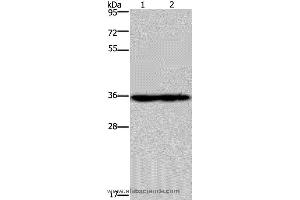 Western blot analysis of Mouse heart and kidney tissue, using NDUFA9 Polyclonal Antibody at dilution of 1:400 (NDUFA9 抗体)