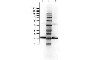 Western Blotting (WB) image for anti-Interleukin 1 Receptor Antagonist (IL1RN) antibody (ABIN5706884)