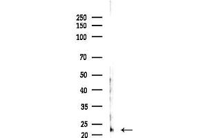 Western blot analysis of lysates from Hela cells(heat-shock,45 min treatment), using REEP6 Antibody at 1/1000 dilution.