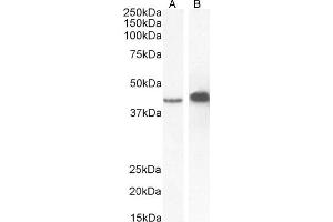 (ABIN2613379) (0. (AMACR 抗体  (C-Term))