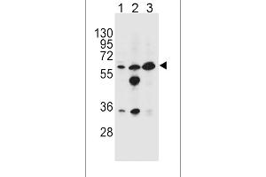 Western blot analysis in HL-60(lane 1),MDA-MB453(lane 2),K562(lane 3) cell line lysates (35ug/lane). (GATM 抗体  (N-Term))