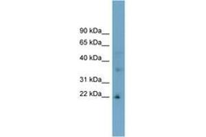 Image no. 1 for anti-Low Density Lipoprotein Receptor Class A Domain Containing 1 (LDLRAD1) (AA 107-156) antibody (ABIN6743318) (LDLRAD1 抗体  (AA 107-156))